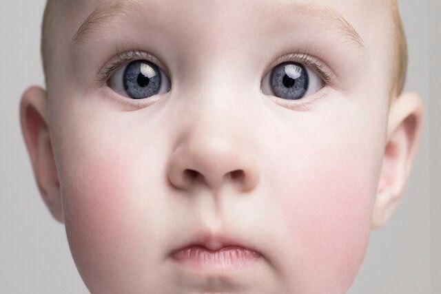 زوال عقل از کودکی می‌آید!